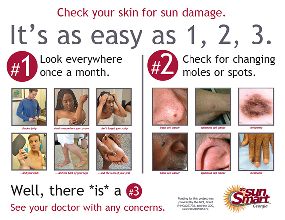 Check Your Skin for Sun Damage Poster